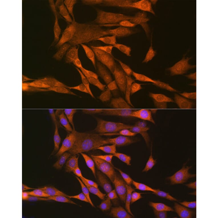 Immunofluorescence - Anti-Thioredoxin/TRX Antibody (A15819) - Antibodies.com