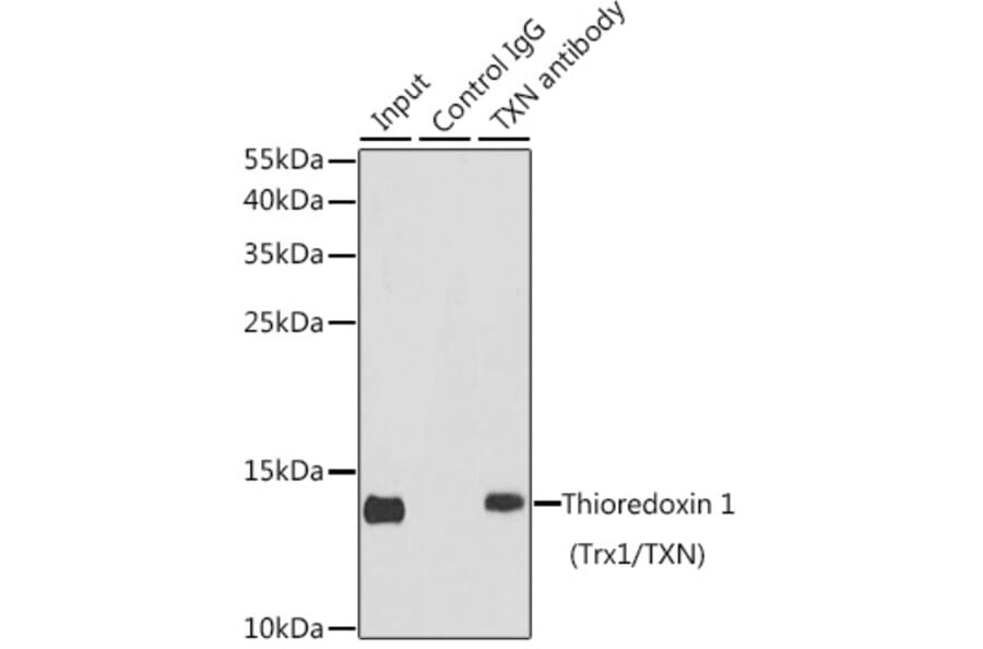 Western Blot - Anti-Thioredoxin/TRX Antibody (A15819) - Antibodies.com
