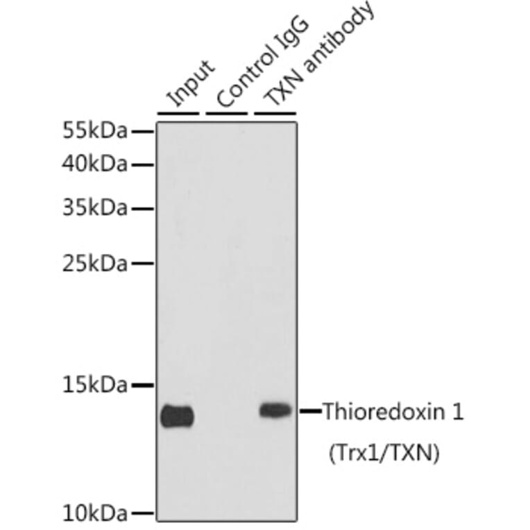 Western Blot - Anti-Thioredoxin/TRX Antibody (A15819) - Antibodies.com