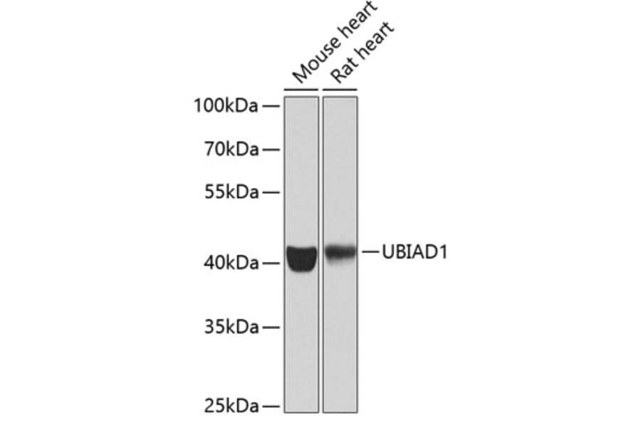 Western Blot - Anti-UBIAD1 Antibody (A15820) - Antibodies.com