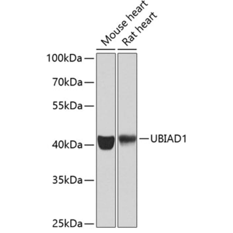 Western Blot - Anti-UBIAD1 Antibody (A15820) - Antibodies.com