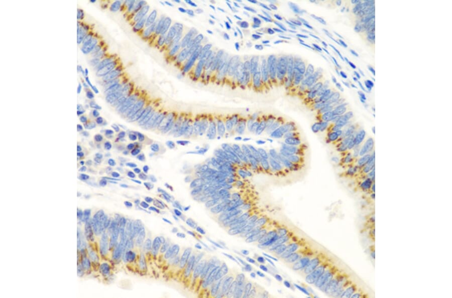 Immunohistochemistry - Anti-UBIAD1 Antibody (A15820) - Antibodies.com