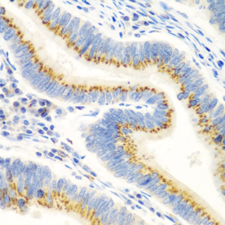 Immunohistochemistry - Anti-UBIAD1 Antibody (A15820) - Antibodies.com