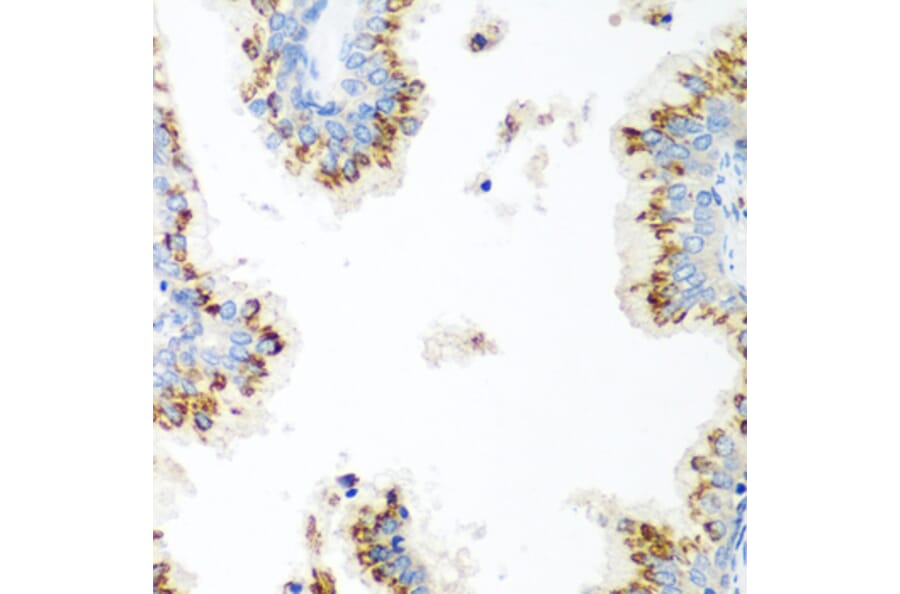 Immunohistochemistry - Anti-UBIAD1 Antibody (A15820) - Antibodies.com