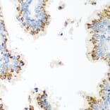 Immunohistochemistry - Anti-UBIAD1 Antibody (A15820) - Antibodies.com