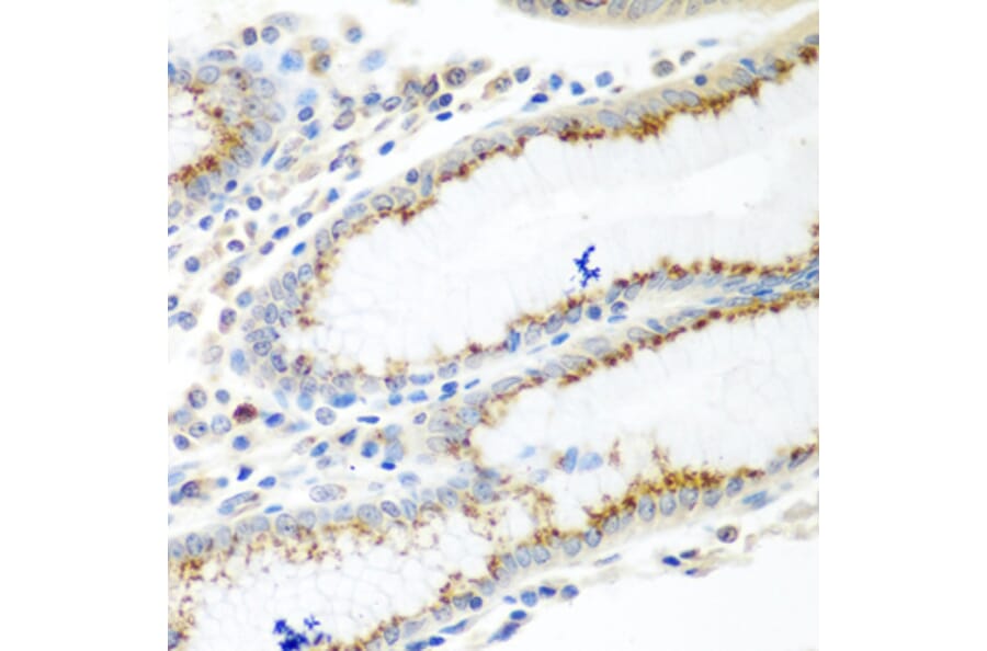 Immunohistochemistry - Anti-UBIAD1 Antibody (A15820) - Antibodies.com