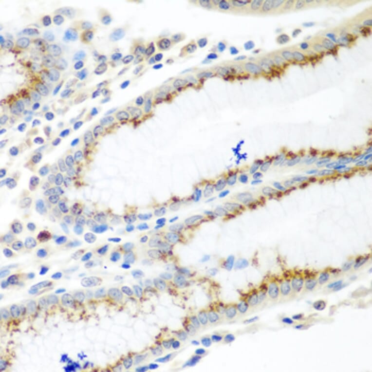 Immunohistochemistry - Anti-UBIAD1 Antibody (A15820) - Antibodies.com