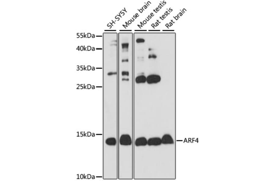 Western Blot - Anti-ARF4 Antibody (A15821) - Antibodies.com