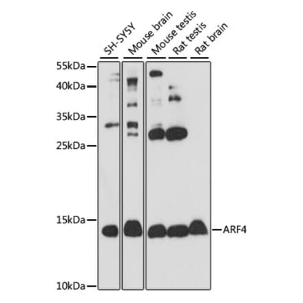 Western Blot - Anti-ARF4 Antibody (A15821) - Antibodies.com