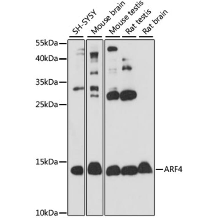Western Blot - Anti-ARF4 Antibody (A15821) - Antibodies.com