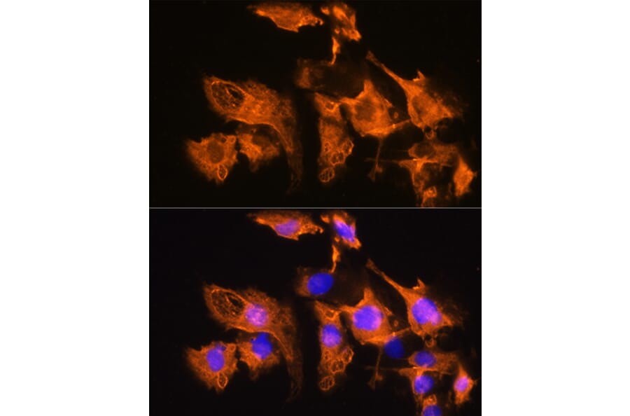 Immunofluorescence - Anti-ARF4 Antibody (A15821) - Antibodies.com