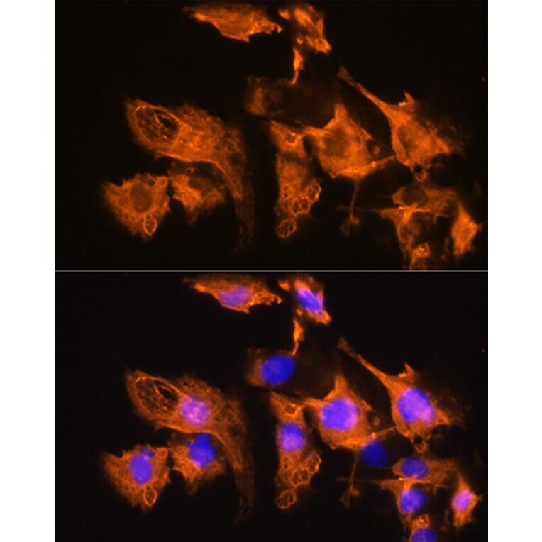 Immunofluorescence - Anti-ARF4 Antibody (A15821) - Antibodies.com