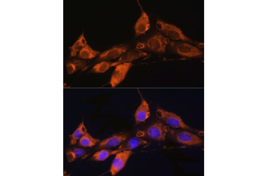 Immunofluorescence - Anti-ARF4 Antibody (A15821) - Antibodies.com