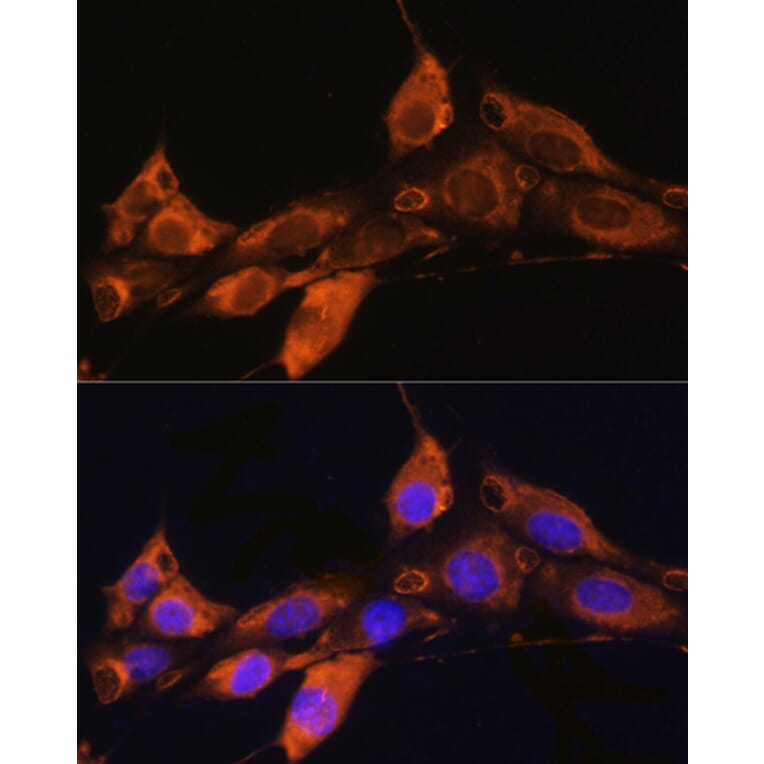 Immunofluorescence - Anti-ARF4 Antibody (A15821) - Antibodies.com