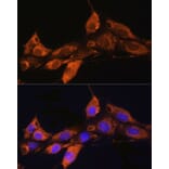 Immunofluorescence - Anti-ARF4 Antibody (A15821) - Antibodies.com