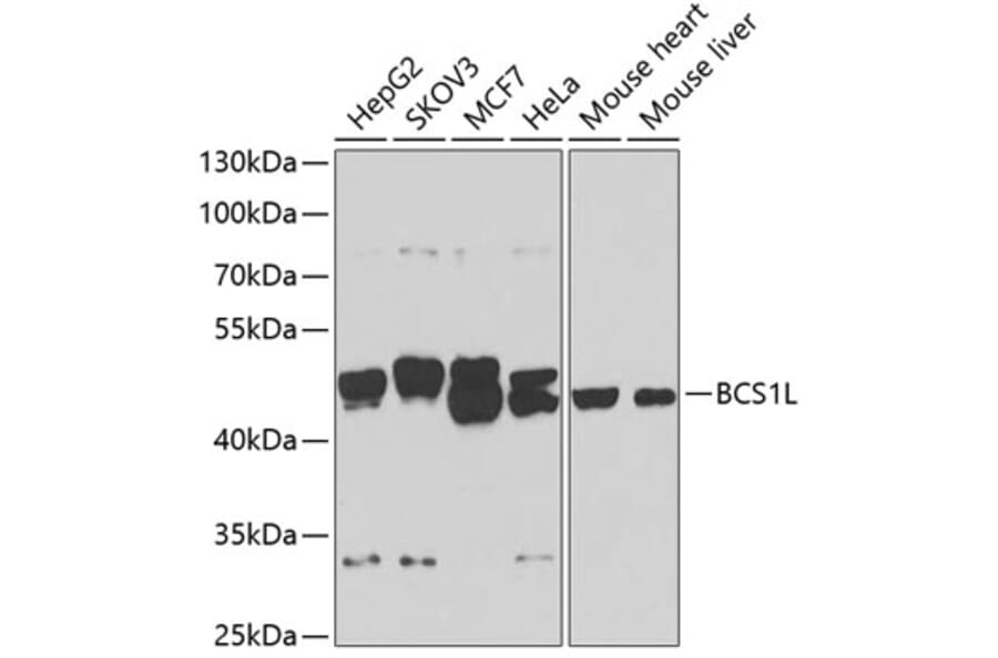 Western Blot - Anti-BCS1L Antibody (A15822) - Antibodies.com