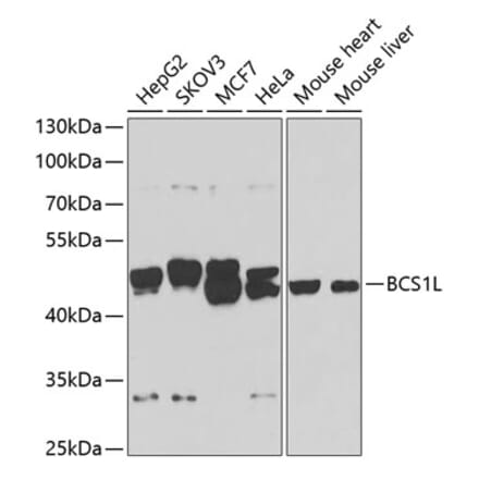 Western Blot - Anti-BCS1L Antibody (A15822) - Antibodies.com