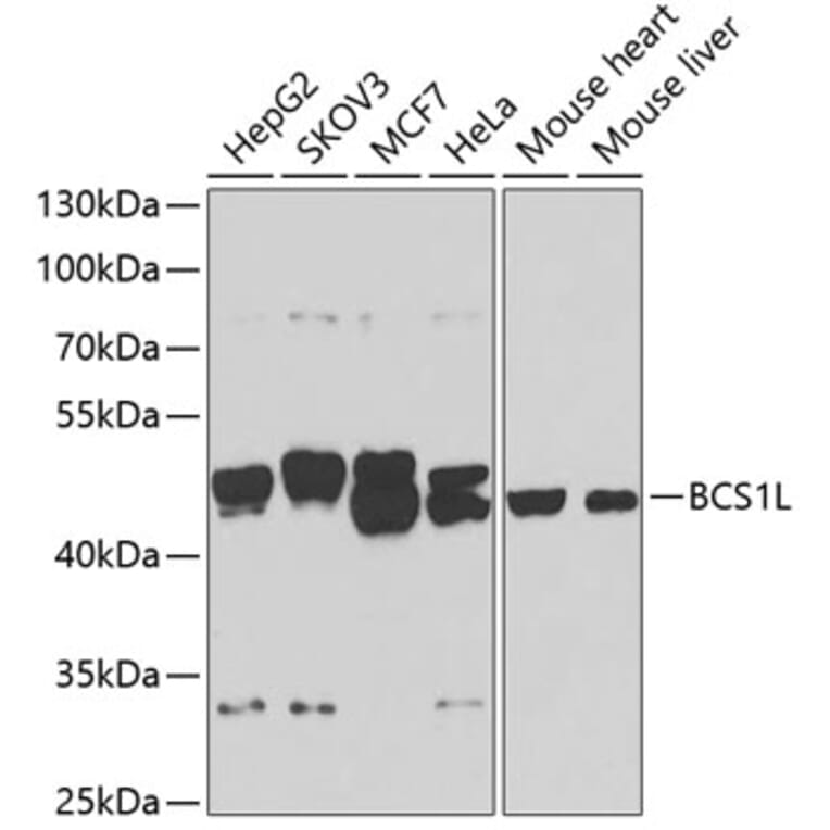 Western Blot - Anti-BCS1L Antibody (A15822) - Antibodies.com