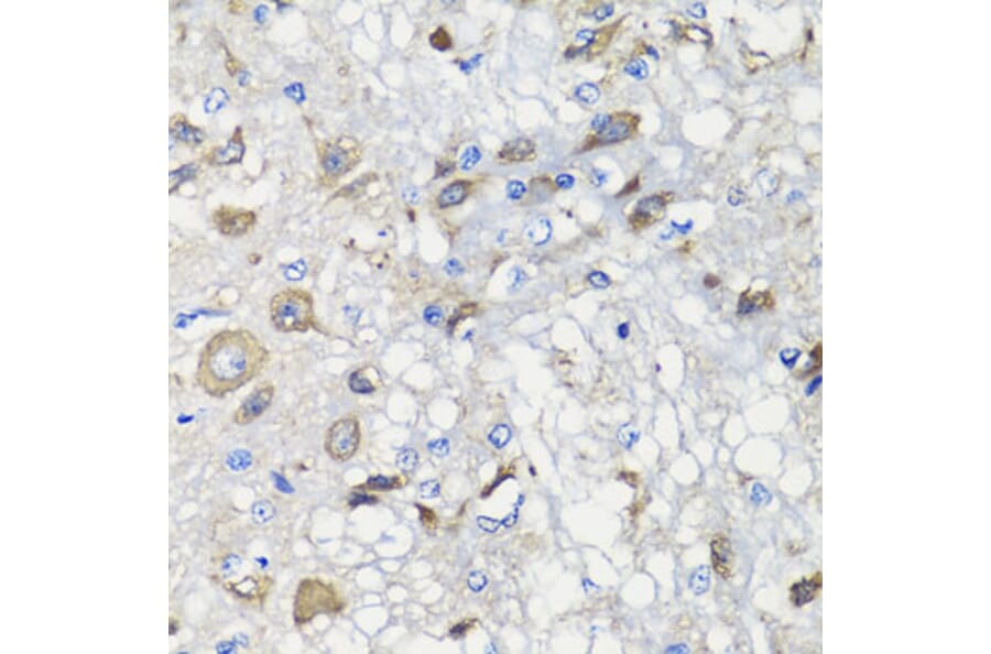 Immunohistochemistry - Anti-BCS1L Antibody (A15822) - Antibodies.com