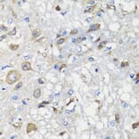 Immunohistochemistry - Anti-BCS1L Antibody (A15822) - Antibodies.com