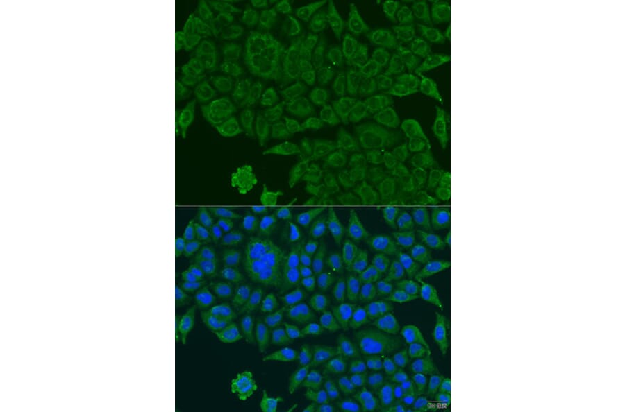Immunofluorescence - Anti-BCS1L Antibody (A15822) - Antibodies.com
