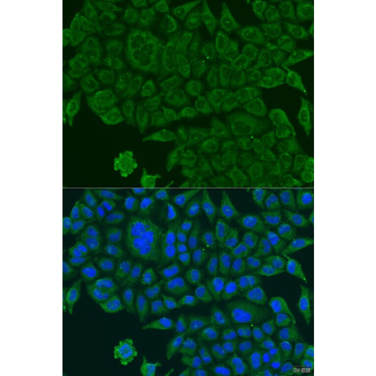 Immunofluorescence - Anti-BCS1L Antibody (A15822) - Antibodies.com