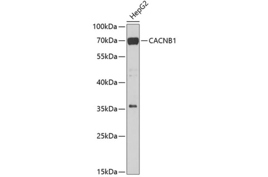 Western Blot - Anti-CACNB1/CAB1 Antibody (A15823) - Antibodies.com