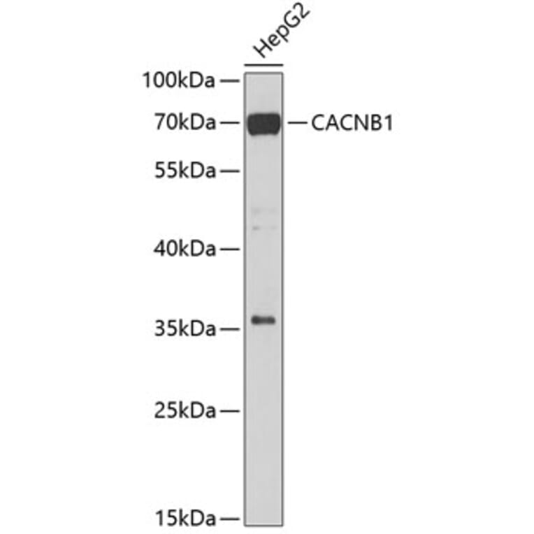 Western Blot - Anti-CACNB1/CAB1 Antibody (A15823) - Antibodies.com