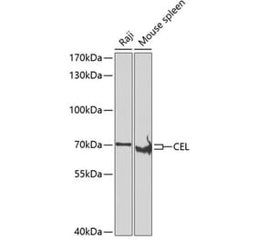 Western Blot - Anti-CEL Antibody (A15824) - Antibodies.com