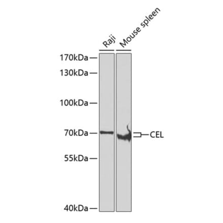Western Blot - Anti-CEL Antibody (A15824) - Antibodies.com
