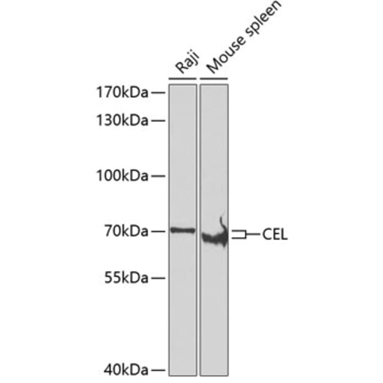 Western Blot - Anti-CEL Antibody (A15824) - Antibodies.com
