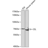 Western Blot - Anti-CEL Antibody (A15824) - Antibodies.com