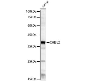 Western Blot - Anti-YKL-39 Antibody (A15825) - Antibodies.com