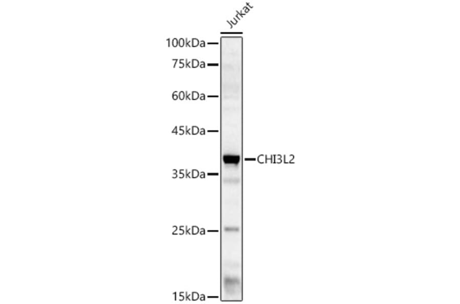 Western Blot - Anti-YKL-39 Antibody (A15825) - Antibodies.com