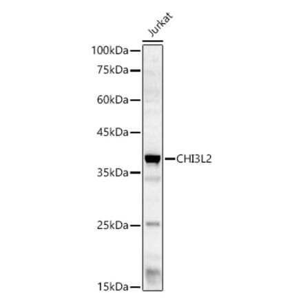 Western Blot - Anti-YKL-39 Antibody (A15825) - Antibodies.com