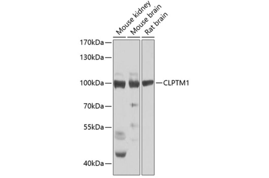 Western Blot - Anti-CLPTM1 Antibody (A15826) - Antibodies.com