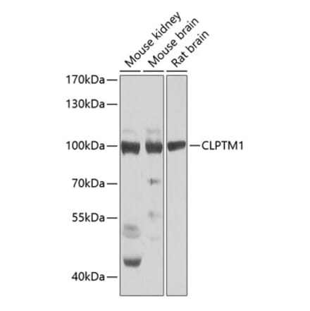 Western Blot - Anti-CLPTM1 Antibody (A15826) - Antibodies.com
