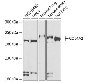 Western Blot - Anti-Collagen IV Antibody (A15827) - Antibodies.com