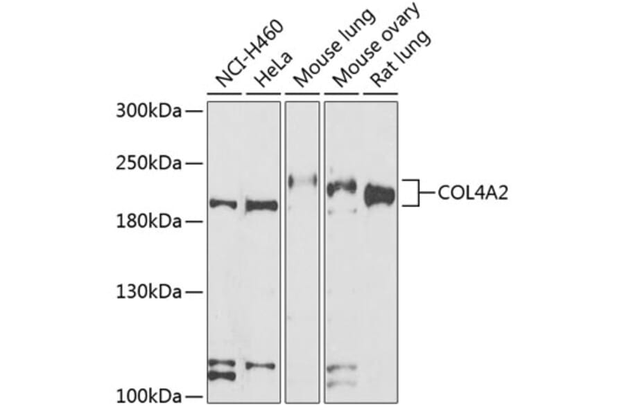 Western Blot - Anti-Collagen IV Antibody (A15827) - Antibodies.com