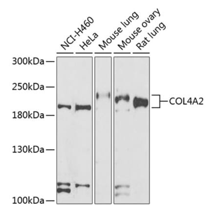 Western Blot - Anti-Collagen IV Antibody (A15827) - Antibodies.com