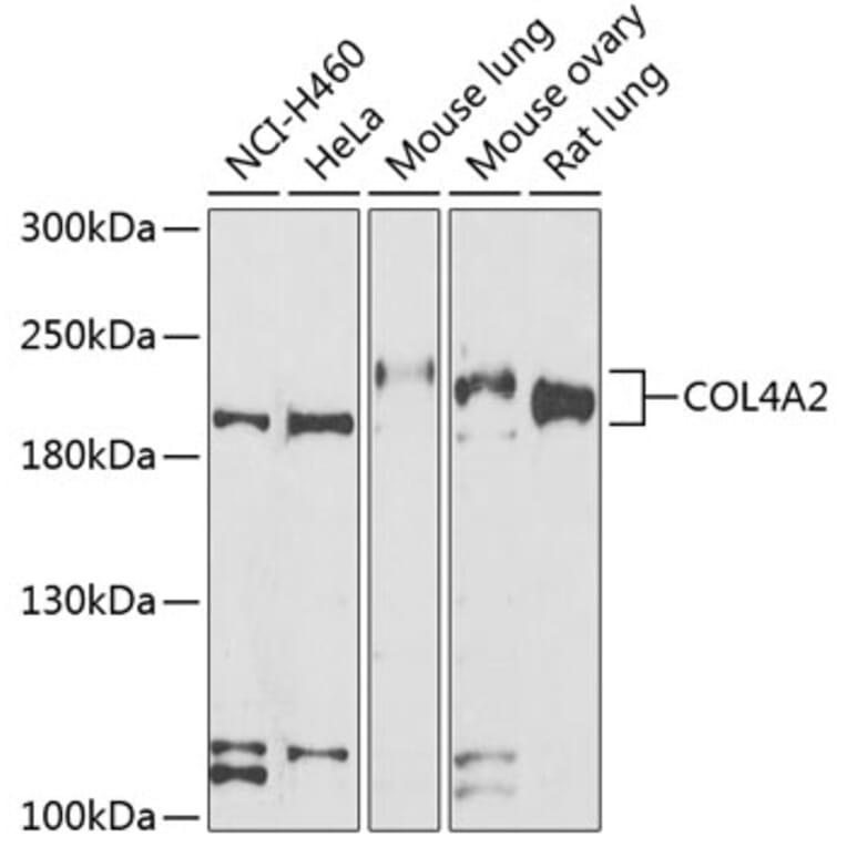 Western Blot - Anti-Collagen IV Antibody (A15827) - Antibodies.com