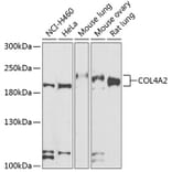 Western Blot - Anti-Collagen IV Antibody (A15827) - Antibodies.com