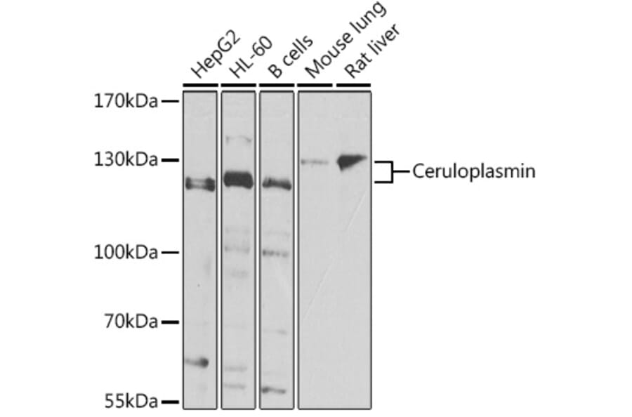Western Blot - Anti-Ceruloplasmin Antibody (A15828) - Antibodies.com