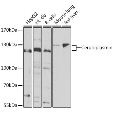 Western Blot - Anti-Ceruloplasmin Antibody (A15828) - Antibodies.com