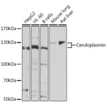 Western Blot - Anti-Ceruloplasmin Antibody (A15828) - Antibodies.com