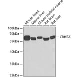 Western Blot - Anti-CRHR2 Antibody (A7659) - Antibodies.com