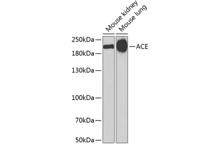 Western Blot - Anti-ACE Antibody (A7665) - Antibodies.com