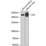 Western Blot - Anti-ACE Antibody (A7665) - Antibodies.com