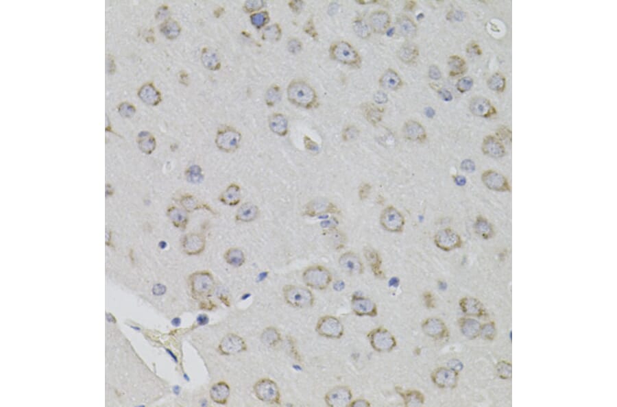Immunohistochemistry - Anti-ACE Antibody (A7665) - Antibodies.com