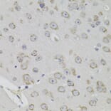 Immunohistochemistry - Anti-ACE Antibody (A7665) - Antibodies.com